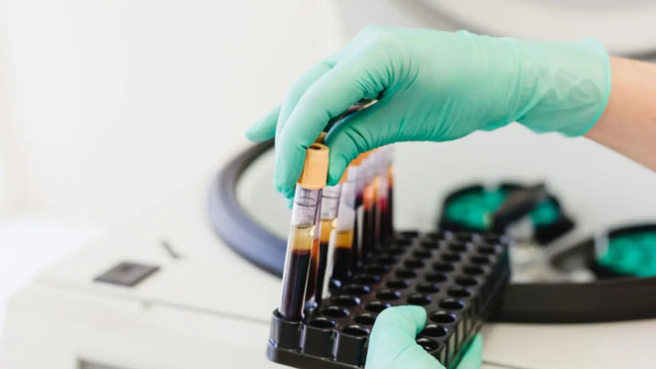 Centre Proposes Amendment to Drugs Rules on Blood Product Testing