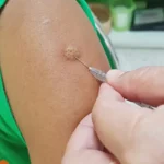 Free Anti-Rabies Vaccination for Benaulim Residents Announced