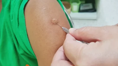 Free Anti-Rabies Vaccination for Benaulim Residents Announced